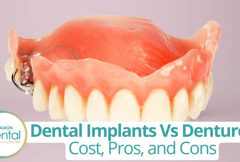 Dental Implants Vs Denture